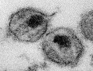 Ultrastructural details of a number of HIV virus particles. <i>Photo Credit: CDC/ A. Harrison; Dr. P. Feorino.</i> Ultrastructural details of a number of HIV virus particles. <i>Photo Credit: CDC/ A. Harrison; Dr. P. Feorino.</i>