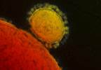 Middle East Respiratory Syndrome Outbreak Traced to Single Super-Spreader Patient Middle East Respiratory Syndrome Outbreak Traced to Single Super-Spreader Patient