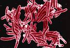 Shorter Tuberculosis Regimens Associated With Greater Treatment Adherence Shorter Tuberculosis Regimens Associated With Greater Treatment Adherence