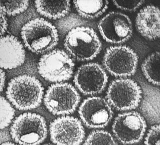 Pritelivir is a novel HSV helicase-primase inhibitor shown to reduce genital shedding and lesions. <i>Photo Credit: CDC/ Dr. Fred Murphy; Sylvia Whitfield.</i> Pritelivir is a novel HSV helicase-primase inhibitor shown to reduce genital shedding and lesions. <i>Photo Credit: CDC/ Dr. Fred Murphy; Sylvia Whitfield.</i>