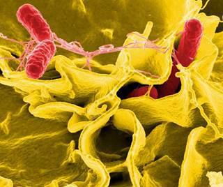 There are about 6,200 resistant culture-confirmed nontyphoidal <i>Salmonella</i> infections annually. <i>Photo Credit: National Institute of Allergy and Infectious Diseases (NIAID).</i> There are about 6,200 resistant culture-confirmed nontyphoidal <i>Salmonella</i> infections annually. <i>Photo Credit: National Institute of Allergy and Infectious Diseases (NIAID).</i>