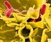 Two New Typhoid Vaccines Show Efficacy in Reducing Rates of Stool Shedding Two New Typhoid Vaccines Show Efficacy in Reducing Rates of Stool Shedding
