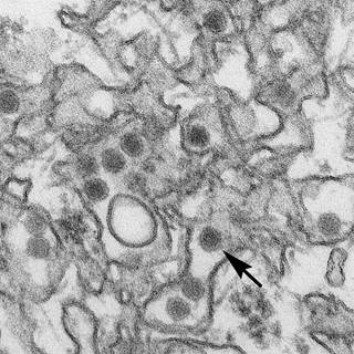 6% of fetuses or infants had evidence of Zika-associated birth defects. <i>Photo Credit: CDC/ Cynthia Goldsmith.</i> 6% of fetuses or infants had evidence of Zika-associated birth defects. <i>Photo Credit: CDC/ Cynthia Goldsmith.</i>