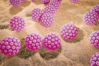 HPV16 DNA detected in fine-needle aspirations from neck masses is a reliable indicator for diagnosis of an HPV-positive oropharyngeal cancer. HPV16 DNA detected in fine-needle aspirations from neck masses is a reliable indicator for diagnosis of an HPV-positive oropharyngeal cancer.