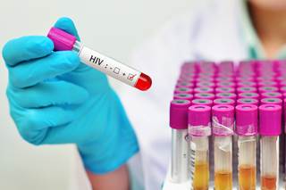 HIV-positive population of the United Kingdom has a higher risk of death than the general population. HIV-positive population of the United Kingdom has a higher risk of death than the general population.