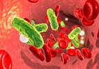 Corticosteroid Use Reduces 28-Day Mortality in Sepsis Corticosteroid Use Reduces 28-Day Mortality in Sepsis