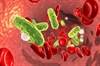 Increased CVD Risk in Men Following Sepsis, Pneumonia Increased CVD Risk in Men Following Sepsis, Pneumonia