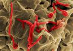 New Ebola Vaccine Highly Effective in Preventing Spread of Disease New Ebola Vaccine Highly Effective in Preventing Spread of Disease