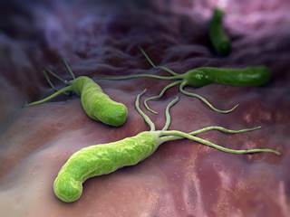 Risk factors for recurrence were peptic ulcer, contact with infected people, and hospitalization. Risk factors for recurrence were peptic ulcer, contact with infected people, and hospitalization.