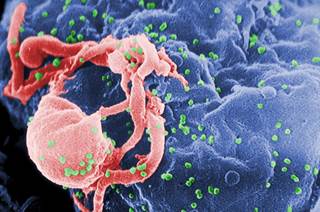 A scanning electron microscopic image of HIV-1 virions budding from a cultured lymphocyte. <i>Photo Credit: CDC/ C. Goldsmith, P. Feorino, E. L. Palmer, W. R. McManus.</i> A scanning electron microscopic image of HIV-1 virions budding from a cultured lymphocyte. <i>Photo Credit: CDC/ C. Goldsmith, P. Feorino, E. L. Palmer, W. R. McManus.</i>