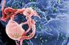Confronting Coronary Heart Disease in HIV/AIDS Confronting Coronary Heart Disease in HIV/AIDS