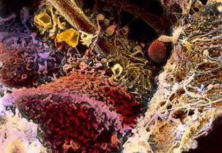 Scanning electron micrograph showing human liver tissue (red-brown) affected by fibrosis. <i>Photo Credit: Professors Pietro M. Motta & Tsuneo Fujita / Science Source.</i> Scanning electron micrograph showing human liver tissue (red-brown) affected by fibrosis. <i>Photo Credit: Professors Pietro M. Motta & Tsuneo Fujita / Science Source.</i>