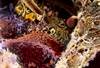 HBV, HCV Increases All-Cause, Liver-Related Mortality in HIV HBV, HCV Increases All-Cause, Liver-Related Mortality in HIV