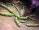 Are Outcomes Worse in Patients With HIV With Community-Acquired Pneumonia? Are Outcomes Worse in Patients With HIV With Community-Acquired Pneumonia?