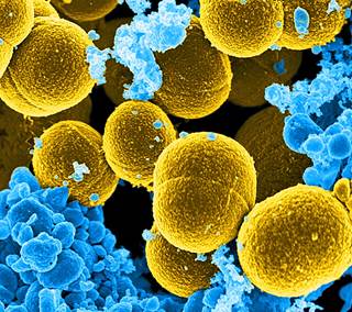 SEM image depicting mustard-colored, spheroid-shaped <i>Staphylococcus aureus</i> bacteria. <i>Photo Credit: Frank DeLeo, National Institute of Allergy and Infectious Diseases (NIAID).</i> SEM image depicting mustard-colored, spheroid-shaped <i>Staphylococcus aureus</i> bacteria. <i>Photo Credit: Frank DeLeo, National Institute of Allergy and Infectious Diseases (NIAID).</i>