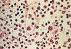 Seoul Virus Outbreak Reported in Illinois and Wisconsin Seoul Virus Outbreak Reported in Illinois and Wisconsin