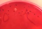Cervicovaginal Microbiome Composition Affects HIV Risk Cervicovaginal Microbiome Composition Affects HIV Risk