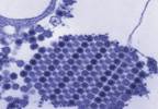 Predictors of Post-Chikungunya Chronic Polyarthralgia Predictors of Post-Chikungunya Chronic Polyarthralgia