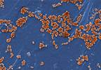 Prevalence of MRSA in ICU Patients After State-Mandated Surveillance Prevalence of MRSA in ICU Patients After State-Mandated Surveillance