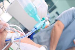 Metabolic alkalosis did not have any effect on 30-day and 12-month mortality in patients with severe sepsis or septic shock. Metabolic alkalosis did not have any effect on 30-day and 12-month mortality in patients with severe sepsis or septic shock.