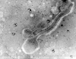 A photomicrograph of a <i>Treponema pallidum</i> bacterium. <i>Photo Credit: CDC, VDRL Dept.</i> A photomicrograph of a <i>Treponema pallidum</i> bacterium. <i>Photo Credit: CDC, VDRL Dept.</i>