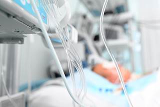 Change of 2 or more points in SOFA score offers greater discrimination for in-hospital mortality. Change of 2 or more points in SOFA score offers greater discrimination for in-hospital mortality.
