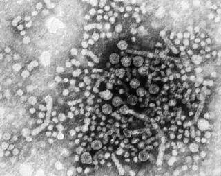 Three patients with chronic HBV and without antiviral prophylaxis developed HBV reactivation but were asymptomatic. <i>Photo Credit: CDC/ Betty Partin.</i> Three patients with chronic HBV and without antiviral prophylaxis developed HBV reactivation but were asymptomatic. <i>Photo Credit: CDC/ Betty Partin.</i>