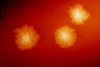 Researchers compared metronidazole and vancomycin on the risk of CDI recurrence and all-cause 30-day mortality. <i>Photo Credit: CDC/Dr Holdeman.</i> Researchers compared metronidazole and vancomycin on the risk of CDI recurrence and all-cause 30-day mortality. <i>Photo Credit: CDC/Dr Holdeman.</i>