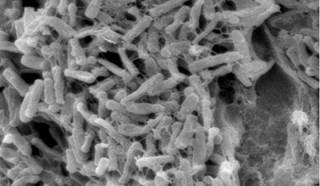 Treatment-emergent adverse events did not differ between extended-pulsed fidaxomicin and vancomycin treatment arms. <i>Photo Credit: CDC/Lois S. Wiggs.</i> Treatment-emergent adverse events did not differ between extended-pulsed fidaxomicin and vancomycin treatment arms. <i>Photo Credit: CDC/Lois S. Wiggs.</i>