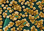 Daptomycin Effective in Treating Serious Skin Infections in Children Daptomycin Effective in Treating Serious Skin Infections in Children