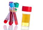 Study Supports Current Prevention Interventions for Zika Exposure Study Supports Current Prevention Interventions for Zika Exposure