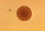Vaginal Microbiota May Affect Tenofovir Applied Intravaginally Vaginal Microbiota May Affect Tenofovir Applied Intravaginally