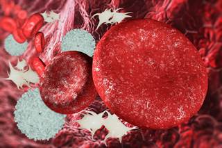 Treatment with DAAs is curative for patients with bleeding disorders who have contracted HCV. Treatment with DAAs is curative for patients with bleeding disorders who have contracted HCV.