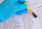 Is CMV a Major Contributor to Cardiovascular Disease in RA? Is CMV a Major Contributor to Cardiovascular Disease in RA?