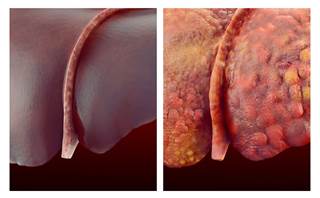 Update to the Technivie label was a result of data from the AGATE-1 trial, which included 120 patients with HCV genotype 4 infection. Update to the Technivie label was a result of data from the AGATE-1 trial, which included 120 patients with HCV genotype 4 infection.