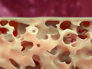 Patients on tenofovir should try to maximize phosphorous in their diet. Patients on tenofovir should try to maximize phosphorous in their diet.