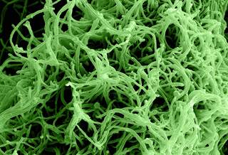 At day 360, all of the active vaccine recipients maintained Ebola virus-specific immunoglobulin G responses. <i>Photo Credit: National Institute of Allergy and Infectious Diseases (NIAID).</i> At day 360, all of the active vaccine recipients maintained Ebola virus-specific immunoglobulin G responses. <i>Photo Credit: National Institute of Allergy and Infectious Diseases (NIAID).</i>