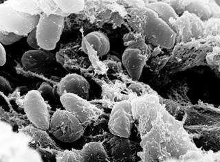 Plague vaccine is being developed as a component of the DoD’s medical countermeasures portfolio against bioterrorism agents. <i>Photo Credit: NIAID; Rocky Mountain Laboratories; NIH.</i> Plague vaccine is being developed as a component of the DoD’s medical countermeasures portfolio against bioterrorism agents. <i>Photo Credit: NIAID; Rocky Mountain Laboratories; NIH.</i>