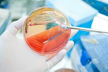 Tetravalent E coli Vaccine Safe, Immunogenic in Women With Recurrent UTI Tetravalent E coli Vaccine Safe, Immunogenic in Women With Recurrent UTI