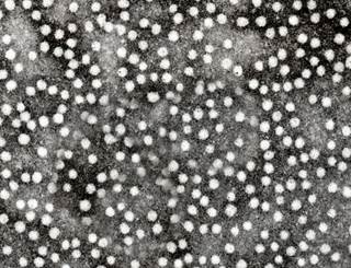 Early decline in HBsAg levels predict entecavir treatment response in chronic HBV genotypes B and C. <i>Photo Credit: GrahamColm at English Wikipedia, via Wikimedia Commons.</i> Early decline in HBsAg levels predict entecavir treatment response in chronic HBV genotypes B and C. <i>Photo Credit: GrahamColm at English Wikipedia, via Wikimedia Commons.</i>