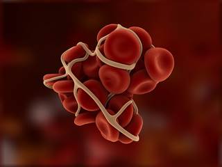 Warfarin dosing, coagulation monitoring should be the same for HIV-infected and HIV-uninfected patients. Warfarin dosing, coagulation monitoring should be the same for HIV-infected and HIV-uninfected patients.