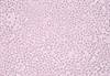 Injectable Antibiotic Promising for Treatment of Complicated UTIs Injectable Antibiotic Promising for Treatment of Complicated UTIs
