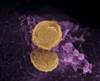 Are Probiotics the Next Wonder Drug in HIV Care? Are Probiotics the Next Wonder Drug in HIV Care?