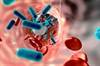Oral Ciprofloxacin Effective in Treatment for Bacteremia Oral Ciprofloxacin Effective in Treatment for Bacteremia