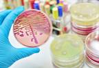 Sepsis May Increase Risk of Long-Term Seizures Sepsis May Increase Risk of Long-Term Seizures