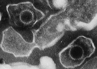 A remote infection with EBV was strongly associated with higher risk of pediatric-onset MS. <i>Photo Credit: Liza Gross, via Wikimedia Commons.</i> A remote infection with EBV was strongly associated with higher risk of pediatric-onset MS. <i>Photo Credit: Liza Gross, via Wikimedia Commons.</i>