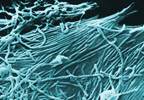 New Ebola Outbreak in the Democratic Republic of Congo New Ebola Outbreak in the Democratic Republic of Congo