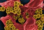 Time to Blood Culture Positivity Predictive of Mortality in <i> S Aureus </i> Infective Endocarditis Time to Blood Culture Positivity Predictive of Mortality in <i> S Aureus </i> Infective Endocarditis