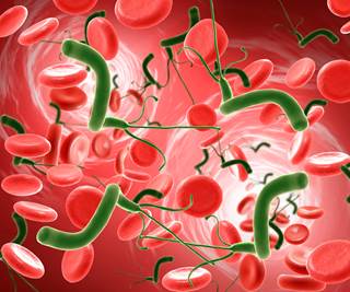 Overall, 150 of 167 patients received <i>H pylori</i> eradication therapy, with a 92% cure rate. Overall, 150 of 167 patients received <i>H pylori</i> eradication therapy, with a 92% cure rate.