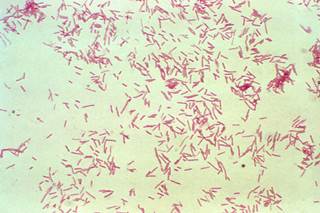 Bacterial taxa predictive of ME/CFS patients with IBS were distinct from taxa associated with ME/CFS patients without IBS. <i>Photo Credit: CDC/Don Stalons.</i> Bacterial taxa predictive of ME/CFS patients with IBS were distinct from taxa associated with ME/CFS patients without IBS. <i>Photo Credit: CDC/Don Stalons.</i>